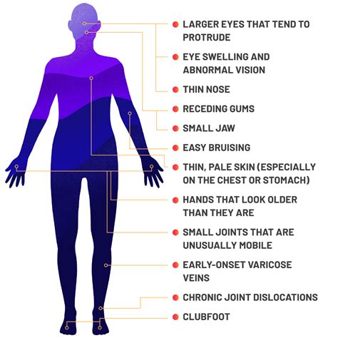 veds symptoms signs body patients similarities often visual across seen